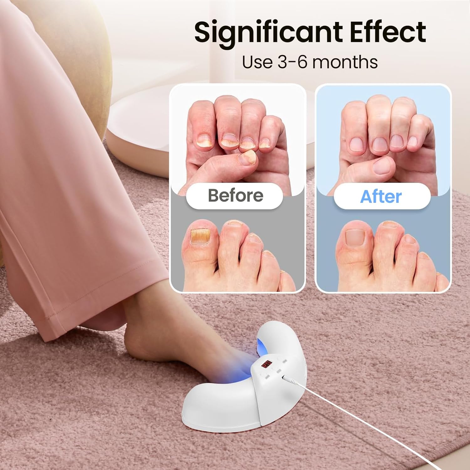 Okita Nail Fungus Lights - Image 9