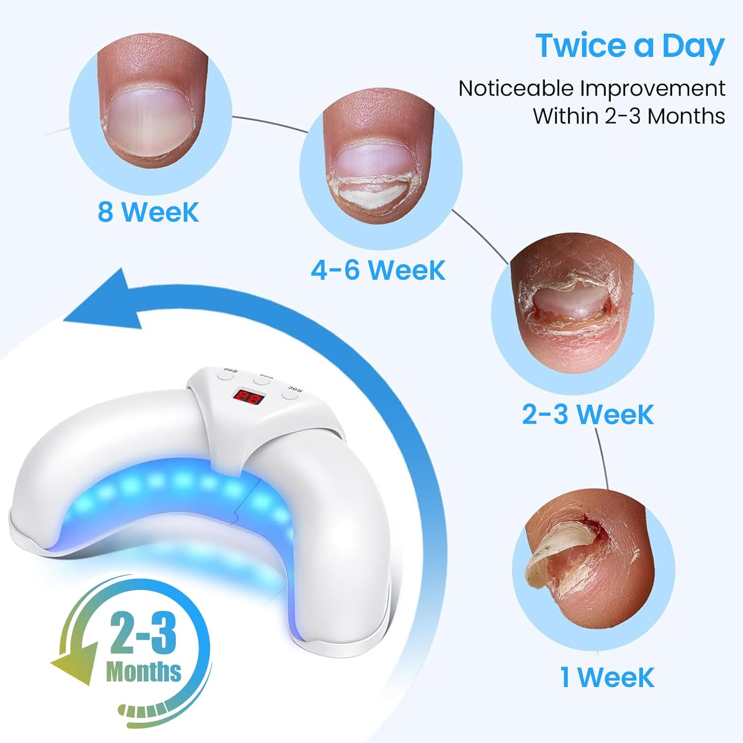 Okita Nail Fungus Lights - Image 10